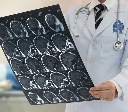 Neurosurgery